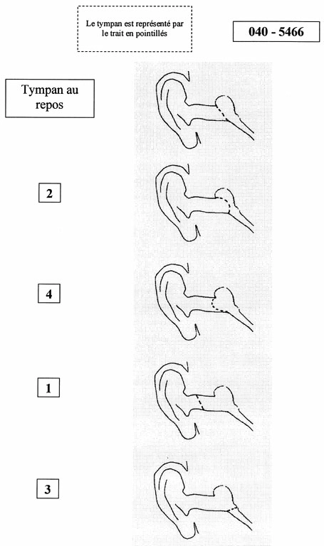 question 040-5466.webp